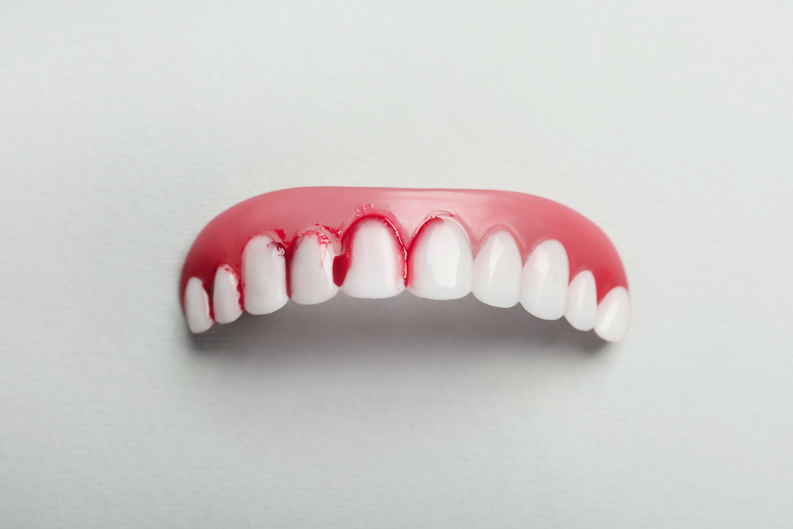 Gingivitis y periodontitis